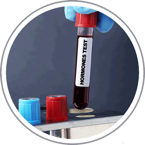 Description of Image