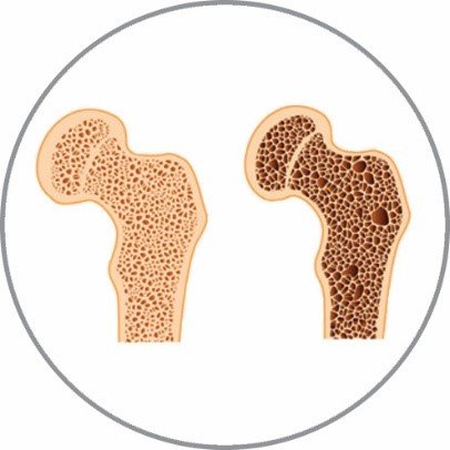 Description of Image